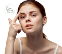 Biomedical Emporium: Anti-Acne Serum