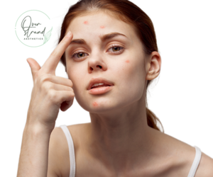 Biomedical Emporium: Anti-Acne Serum