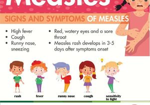 Safe and Effective Measles Vaccine For Children Under 15 Years