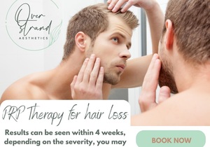 PRP for Hair Loss