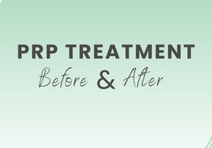 Get Amazing Skin with PRP Treatment at Overstrand Aesthetics!