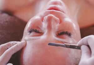 Dermaplaning Treatment for Radiant, Smooth Skin