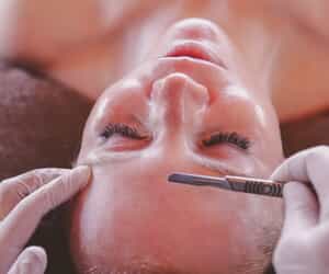 Dermaplaning Treatment for Radiant, Smooth Skin