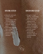 Restore Hydrated, Glowing Skin at Overstrand Aesthetics