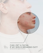 Breakouts Don’t Mean You Have to Avoid Facials