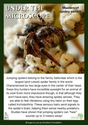 What’s Under the Microscope? A Spider’s Secret Listening System!