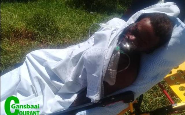 ‘n  Ernstig  beseerde  plaaswerker  Lundi  Tshayinca, ook bekend as Patrick, nadat hy na bewering deur sy vriendin aangeval is.