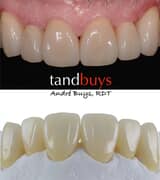 CROWN AND BRIDGE WORK LAB