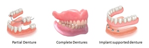 DENTURE LAB