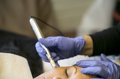 The_Beauty_Spot_Pen_Treatment_2_1502711190