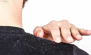 What really works on dandruff?