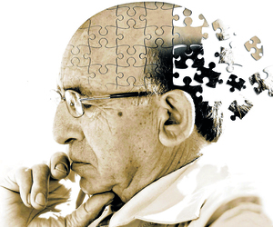Facts about Alzheimer's