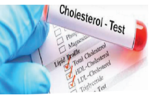 Beheer jou cholesterol - beskerm jouself teen ’n hartaanval en ’n beroerte