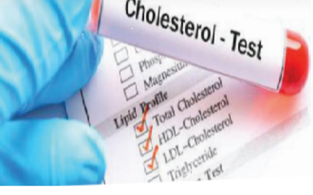 Gansbaai Pharmacy - Cholesterol Test