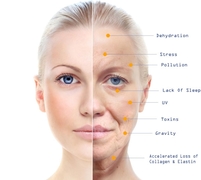 Benefits of Micro-Needling