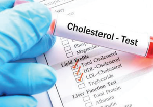 What Is High Cholesterol?