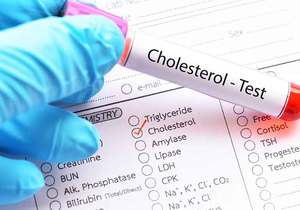 Why Are Statins Controversial?