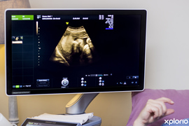 Coronavirus & Pregnancy