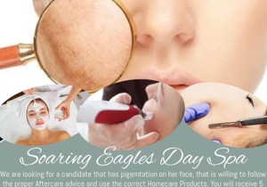 Candidate Needed For Pigmentation Removal Treatment