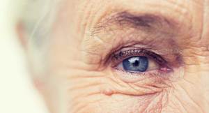 7 Ways To Prevent Wrinkles