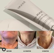 MAX Stem Cell Neck Lift Creme